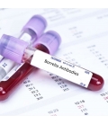 Test Kit Αιματολογικών Εξετάσεων ArminLabs
