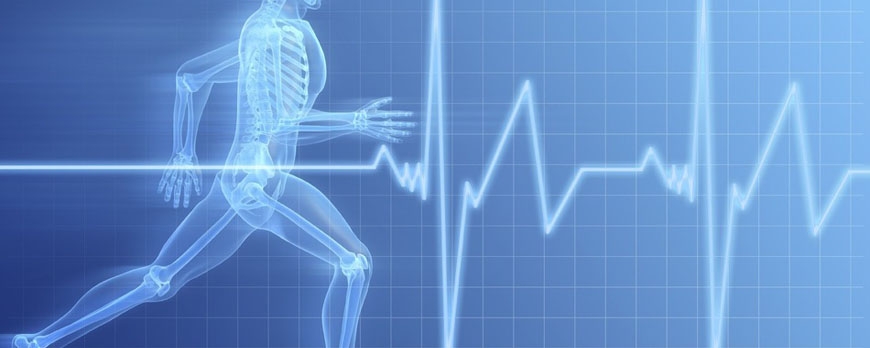 Έντονη άσκηση και ανάπτυξη καρδιακής αρρυθμίας